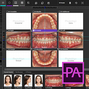 PhotoAlign Studio
